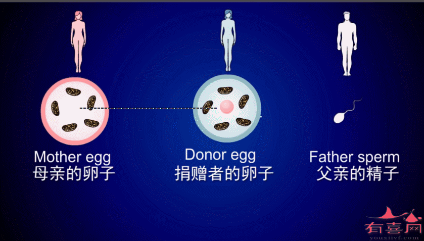 供卵试管代怀双胞胎零风险_零风险:供卵试管代怀双胞胎新选择